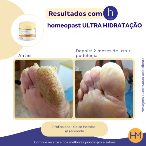 Ultra Hidratação